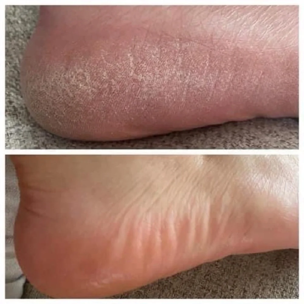 Pedicure in a bottle - Picture 2 of 9